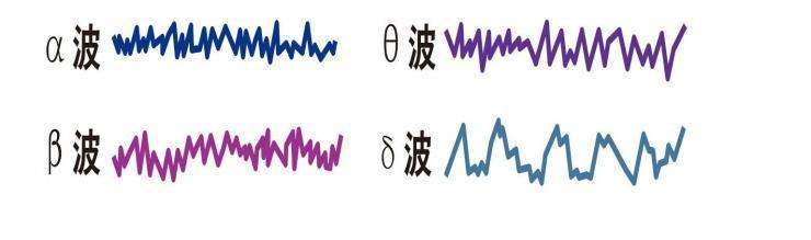 儿童癫痫做二十四小时脑电图，怎么做？