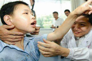 癫痫病对儿童的危害有哪些